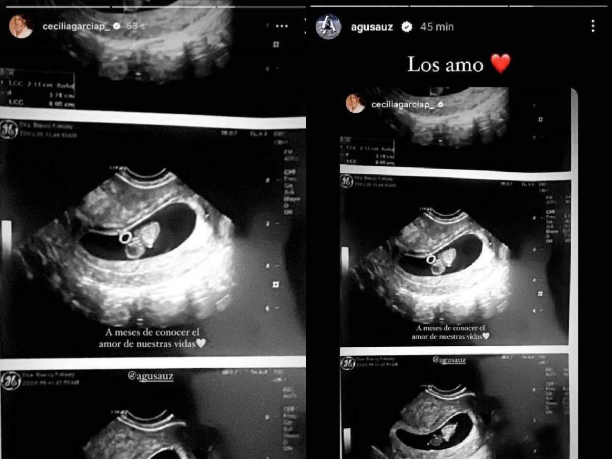 Cecilia García hace confesión sobre su embarazo con Agustín Auzmendi