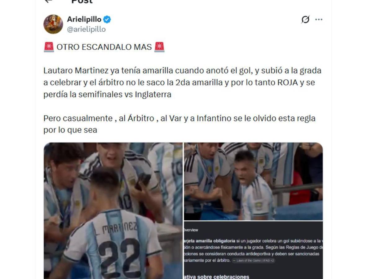 Destapan la verdad de la roja a Embolo y la otra polémica a Argentina que nadie vio
