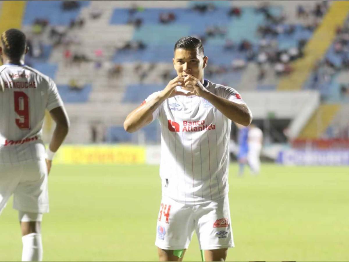 Las bellezas, Victoria amarga a Olimpia y lindo detalle en el Nacional