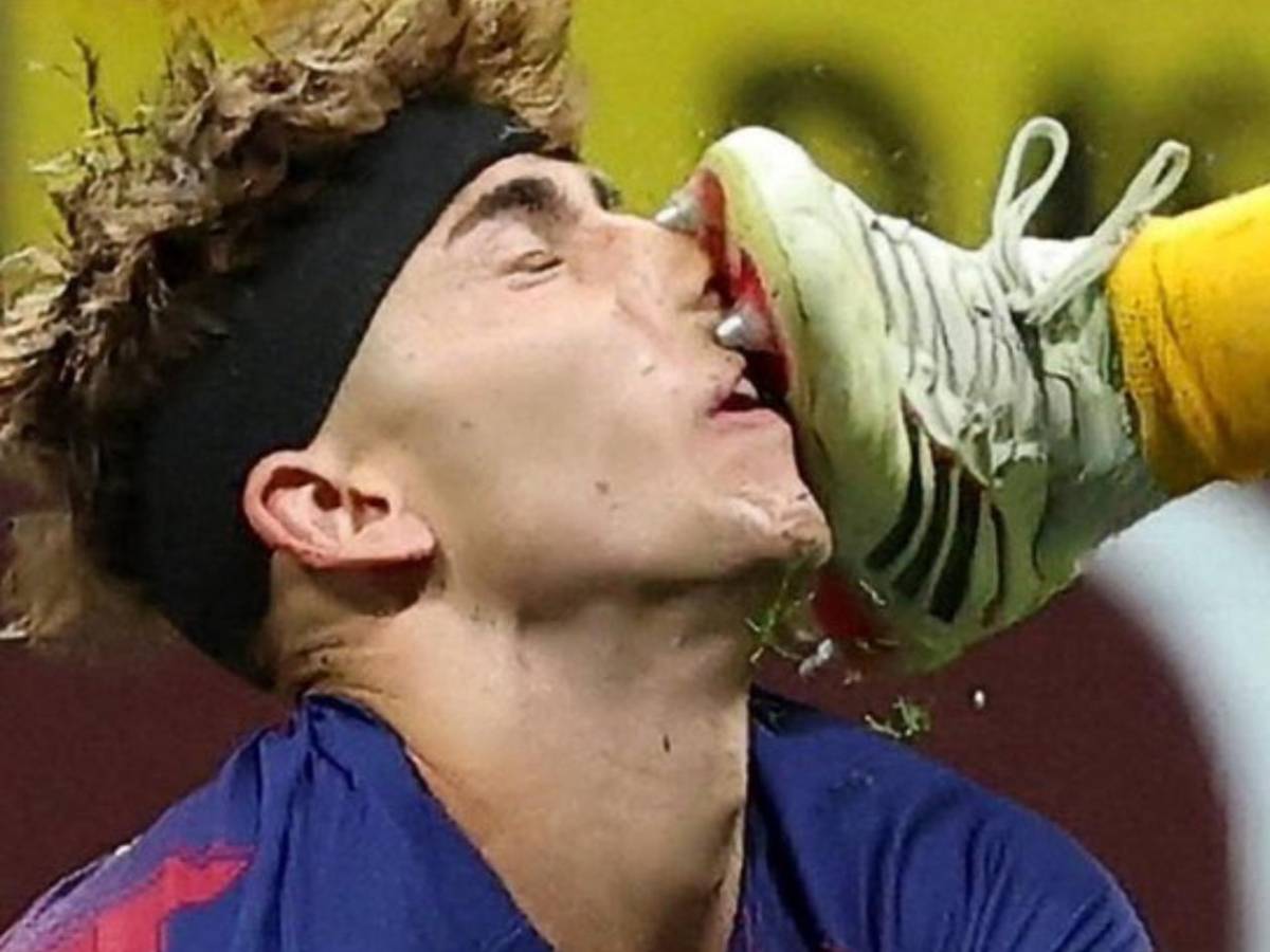 Enfado y llanto en Barcelona, insólito error y lo que hizo Yamal tras eliminación