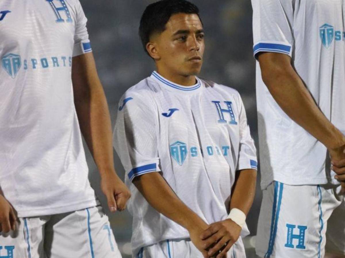 Polache brilla en el show, luego buscan culpable en el camerino