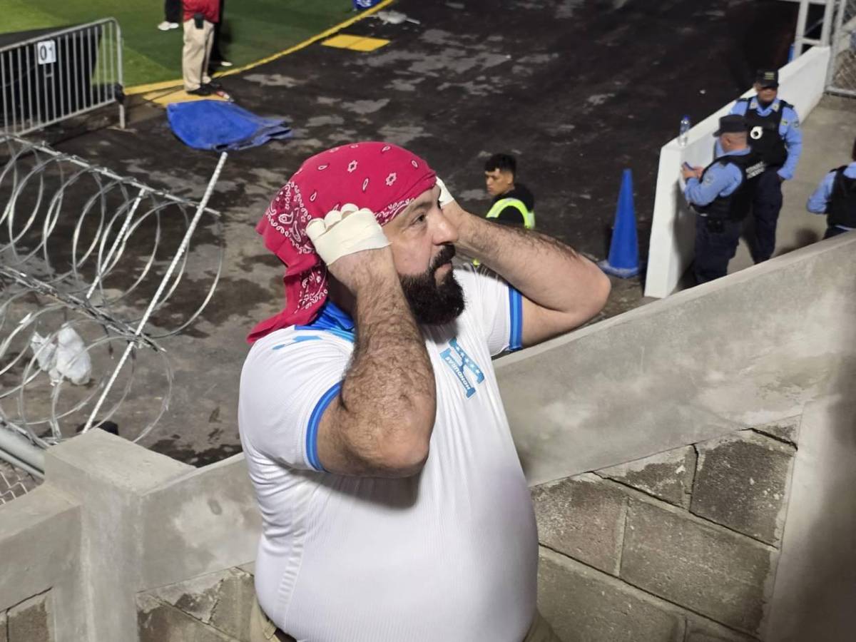 ¿Qué pasó con Luis Redondo en el estadio durante el Honduras- Antigua y Barbuda?