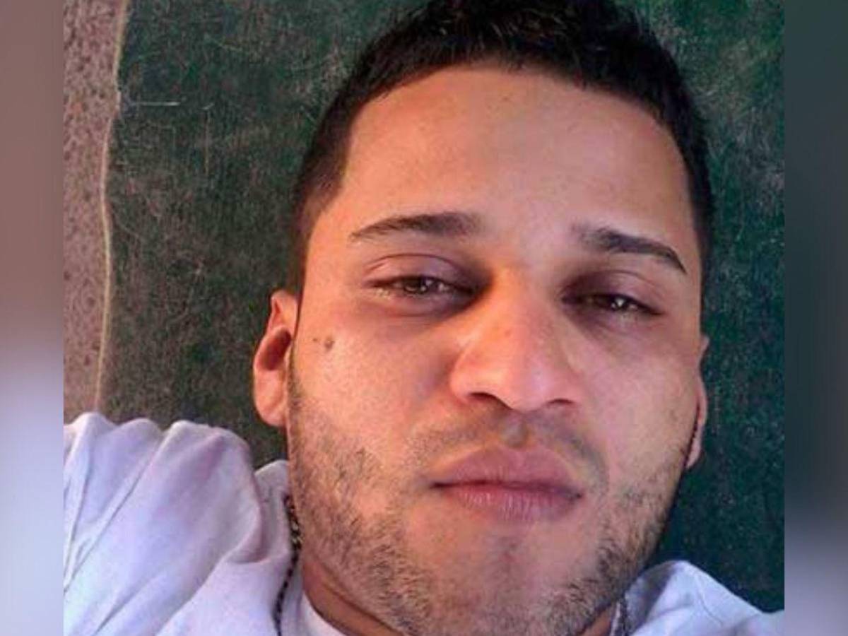 Como si fuera un pitbull: Hombre ataca a mordidas a su pareja en Olancho