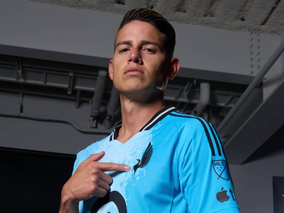 ¿James Rodríguez sufre de rabdomiólisis mortal? Surge noticia sobre el colombiano