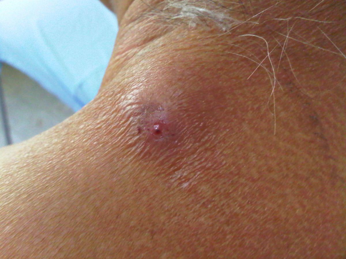 México y Guatemala trabajan para evitar la entrada del gusano barrenador