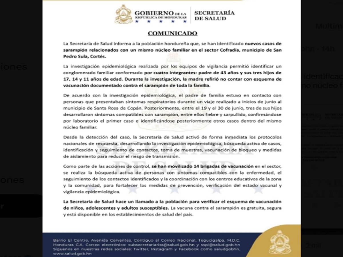 Cuatro miembros de una familia en San Pedro Sula dan positivo a sarampión