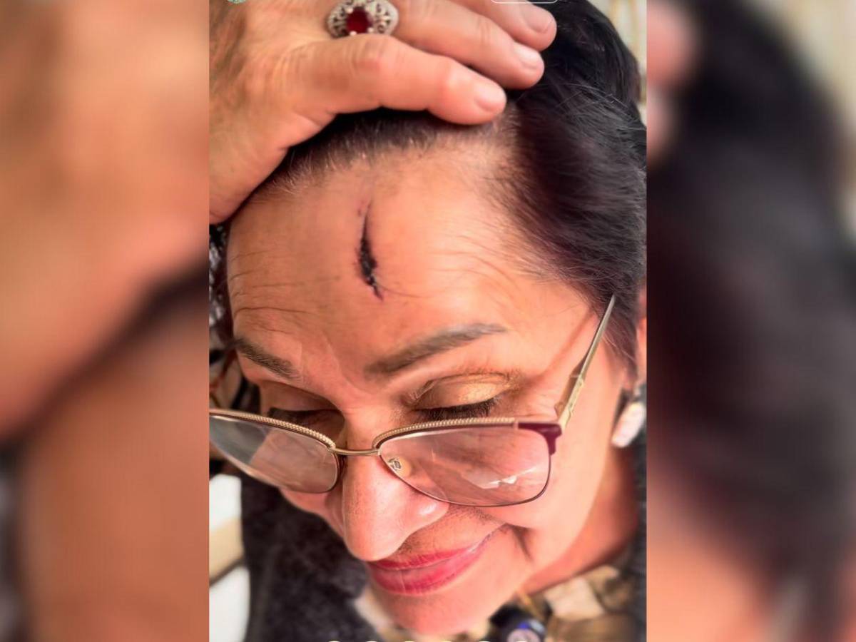 Mamá de Alejandra Rubio sufre accidente y comparte cómo ocurrió