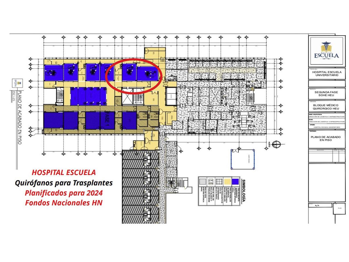 Plano del quirófano especializado para trasplantes renales en el Hospital Escuela.