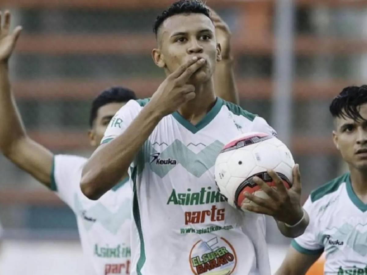 ¡De casi perder el pie a debutar en Champions! La increíble historia de Arriaga