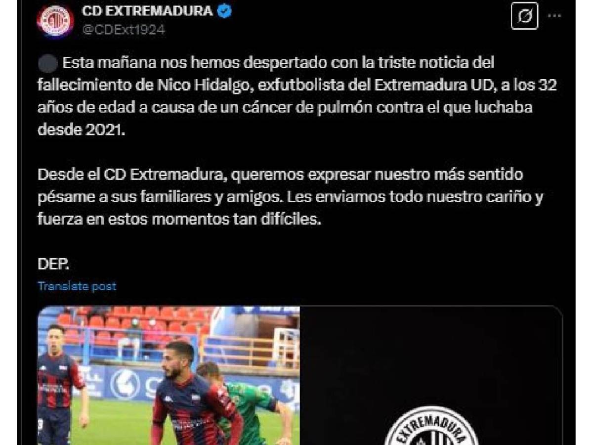 Conmoción: muere reconocido jugador en España tras dura enfermedad