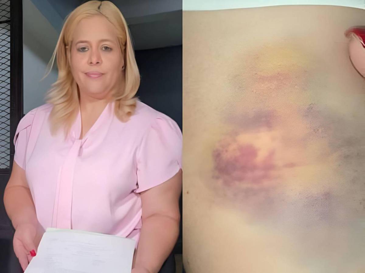 Kathia Crivelli denuncia que dañaron su carro y culpa a Libre