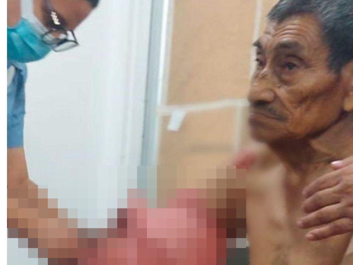 Tres pitbulls atacan a anciano y una niña en Juticalpa