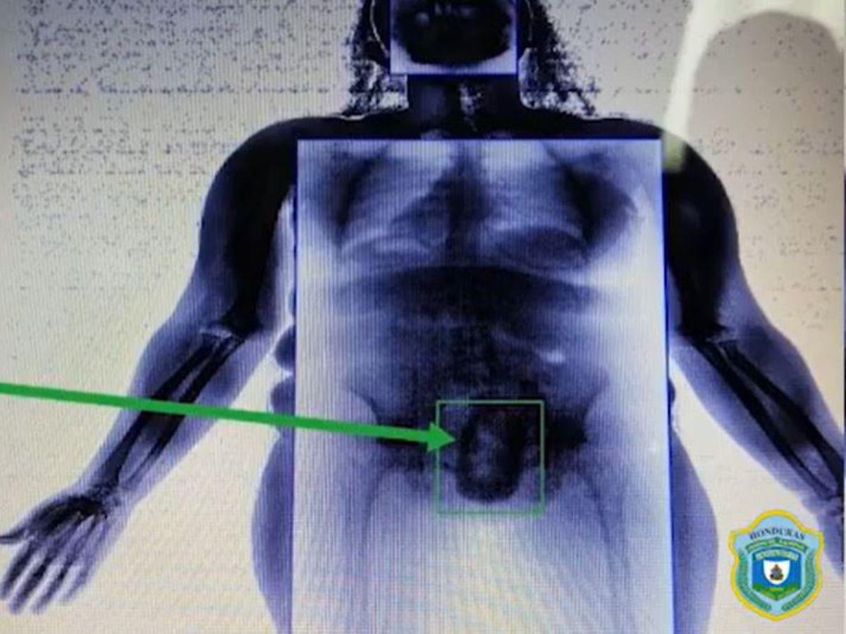 $!Mujeres son utilizadas por grupos criminales para ingresar artículos prohibidos a las cárceles.