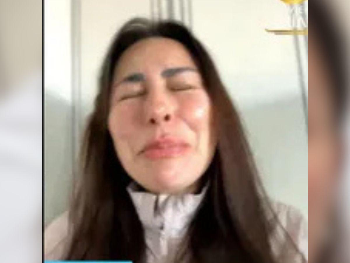 Querida actriz de Televisa sufre ataque de un pitbull: Puedo perder una extremidad