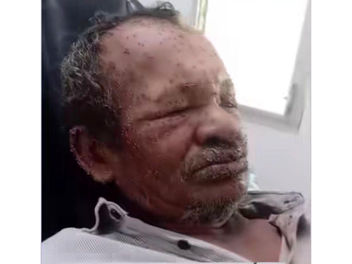 Hombre muere tras ser atacado por un enjambre de abejas en Choluteca