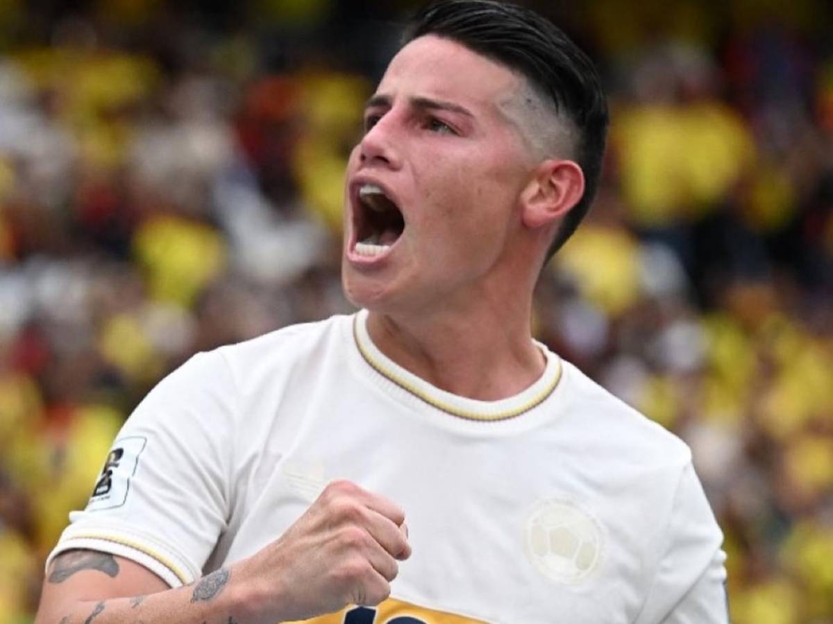 ¿James Rodríguez sufre de rabdomiólisis mortal? Surge noticia sobre el colombiano