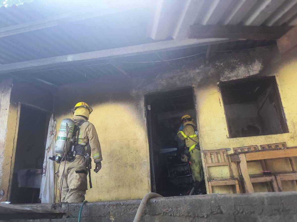 Muere niño que sufrió graves quemaduras tras incendio en La Ceiba