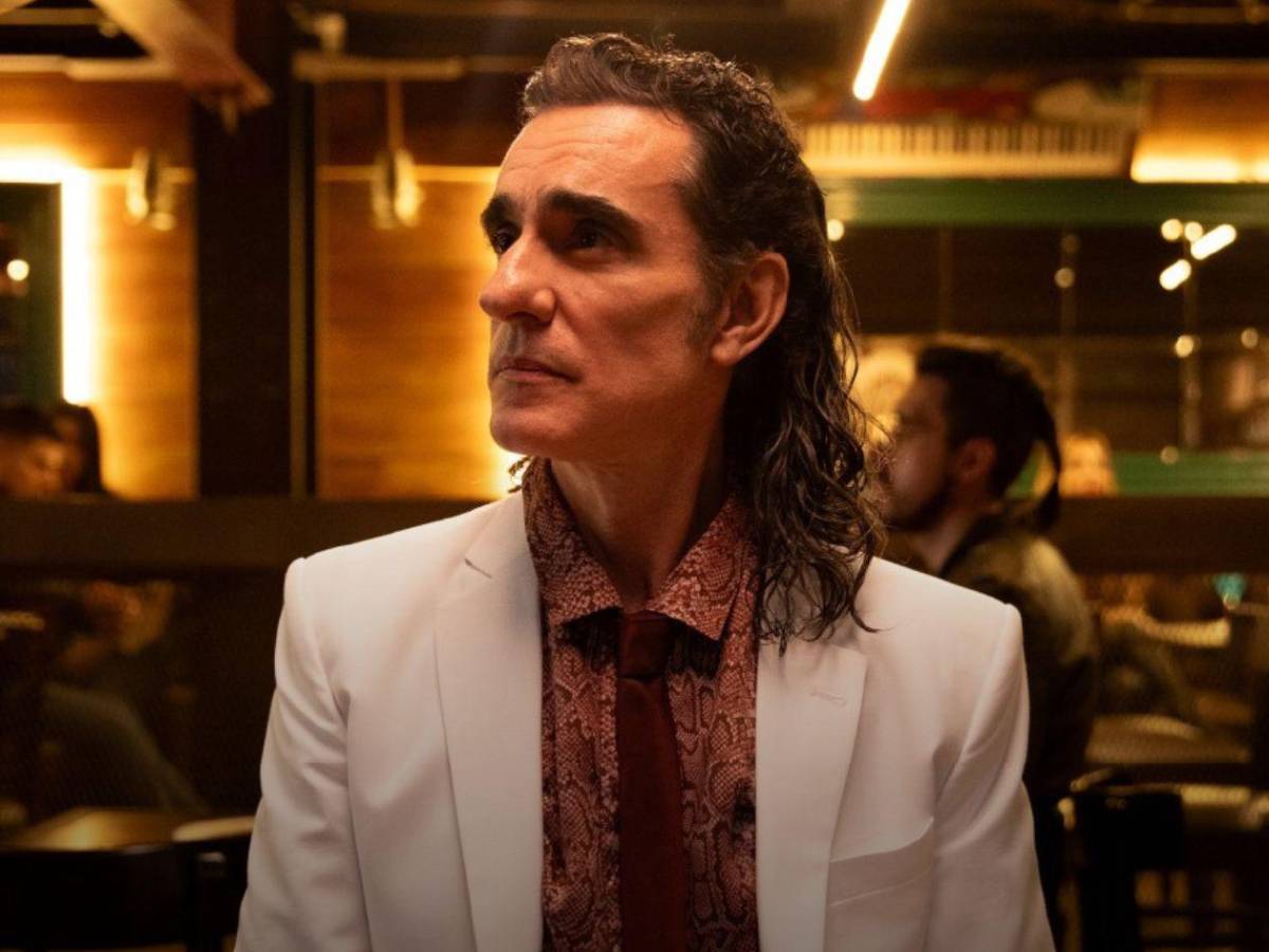 Antes y después del actor de Pedro el Escamoso, Miguel Varoni tras cirugía