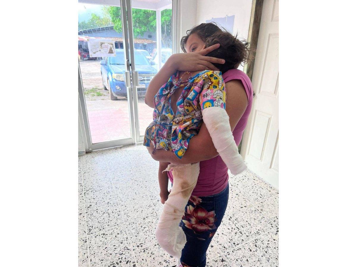 “Le quemó y fracturó”: DPI va tras padrastro acusado de torturar a niño en Santa Bárbara