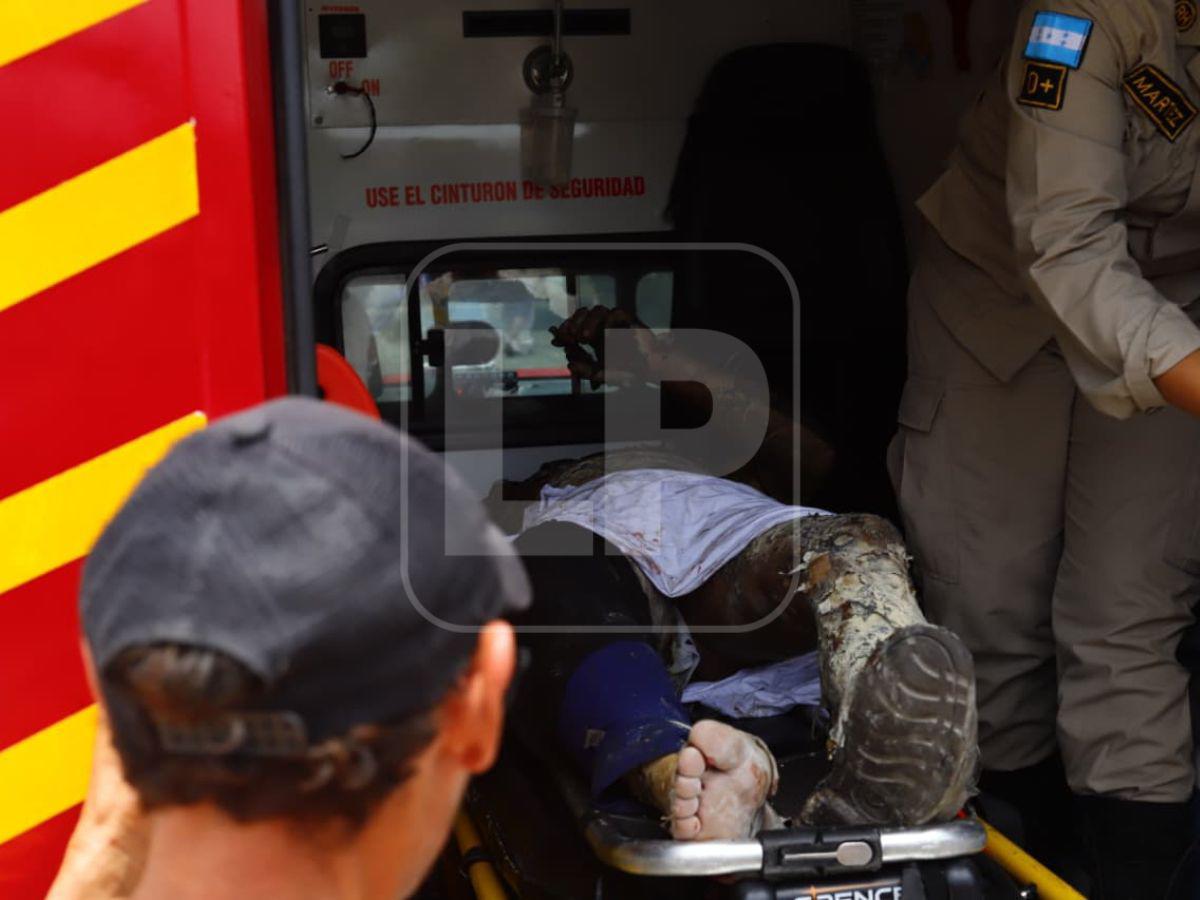 Bus rapidito de la ruta 2 se incendia tras choque con motocicleta en SPS