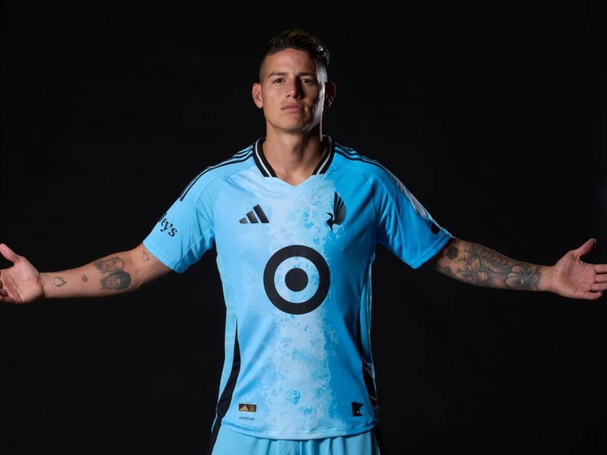 ¿James Rodríguez sufre de rabdomiólisis mortal? Surge noticia sobre el colombiano