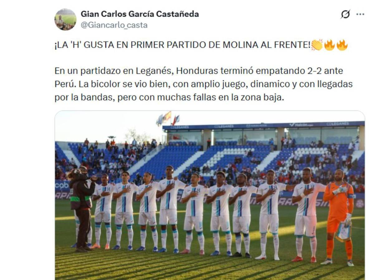 Ilusión en Honduras, sorpresa en Perú y señalan a futbolista tras el amistoso