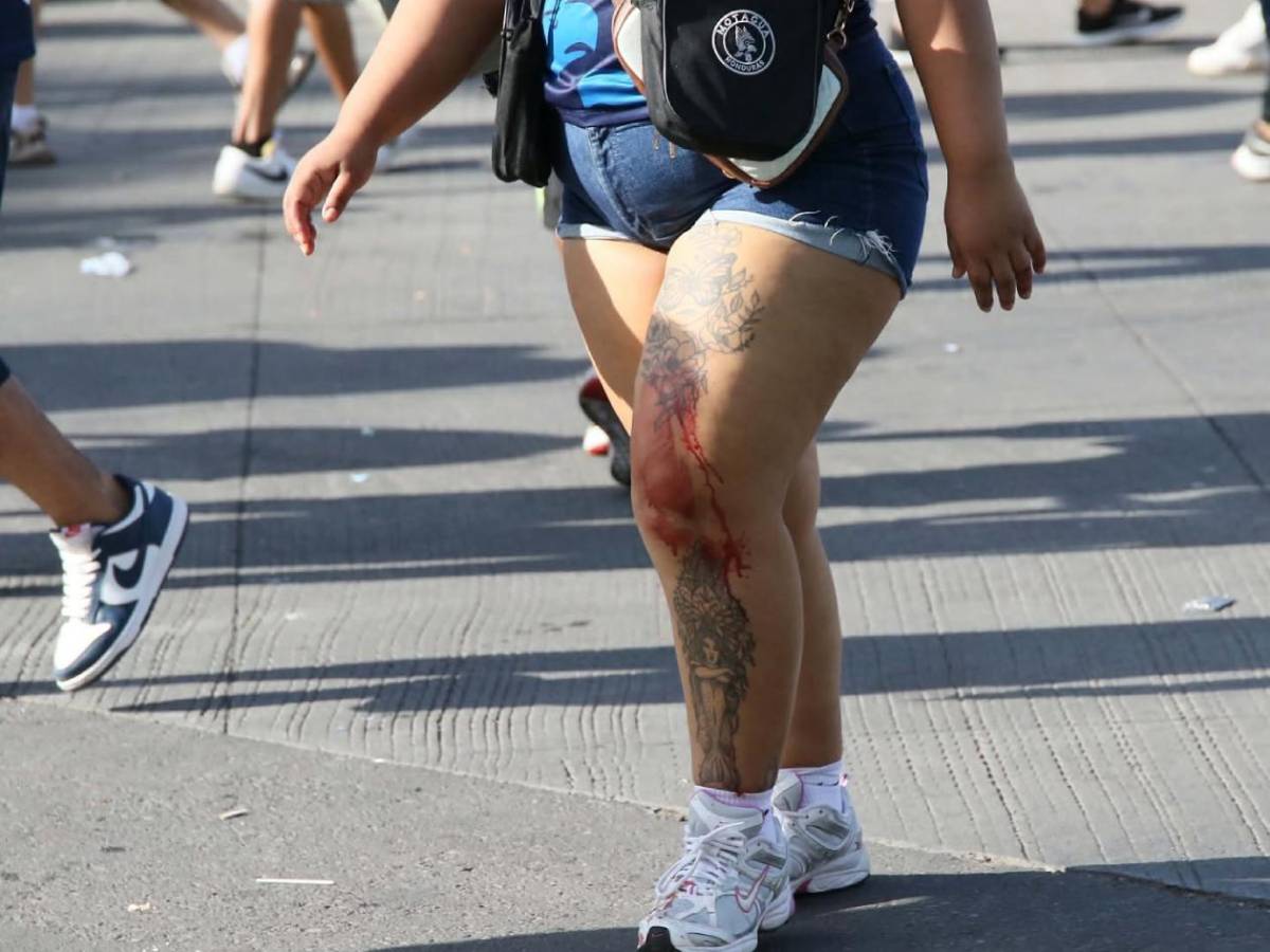 Imágenes impactantes: Terror en clásico Motagua - Olimpia tras escenas de violencia