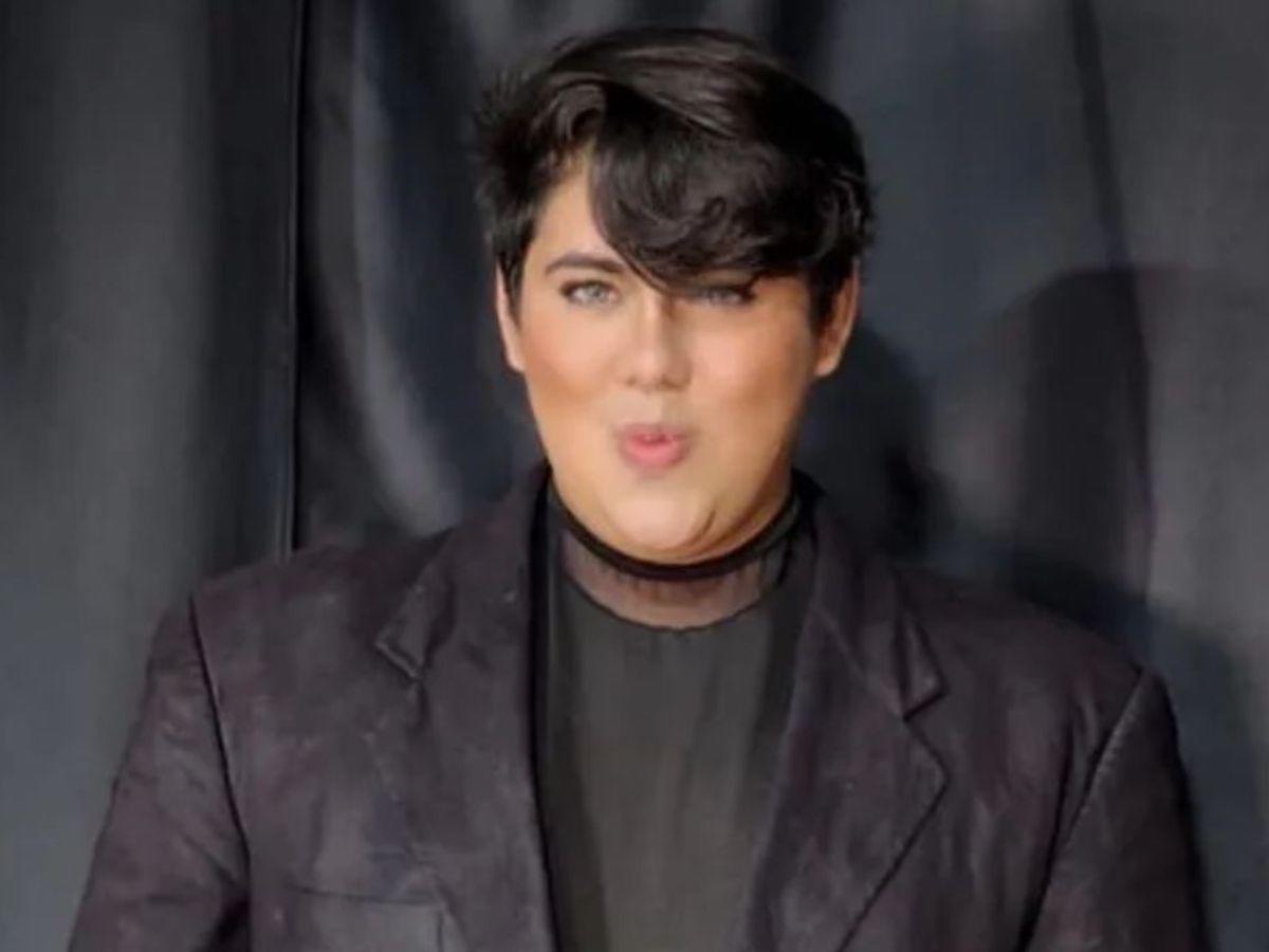 Antonio Sandrez presume sus nuevos labios: “Atáquense y admiren