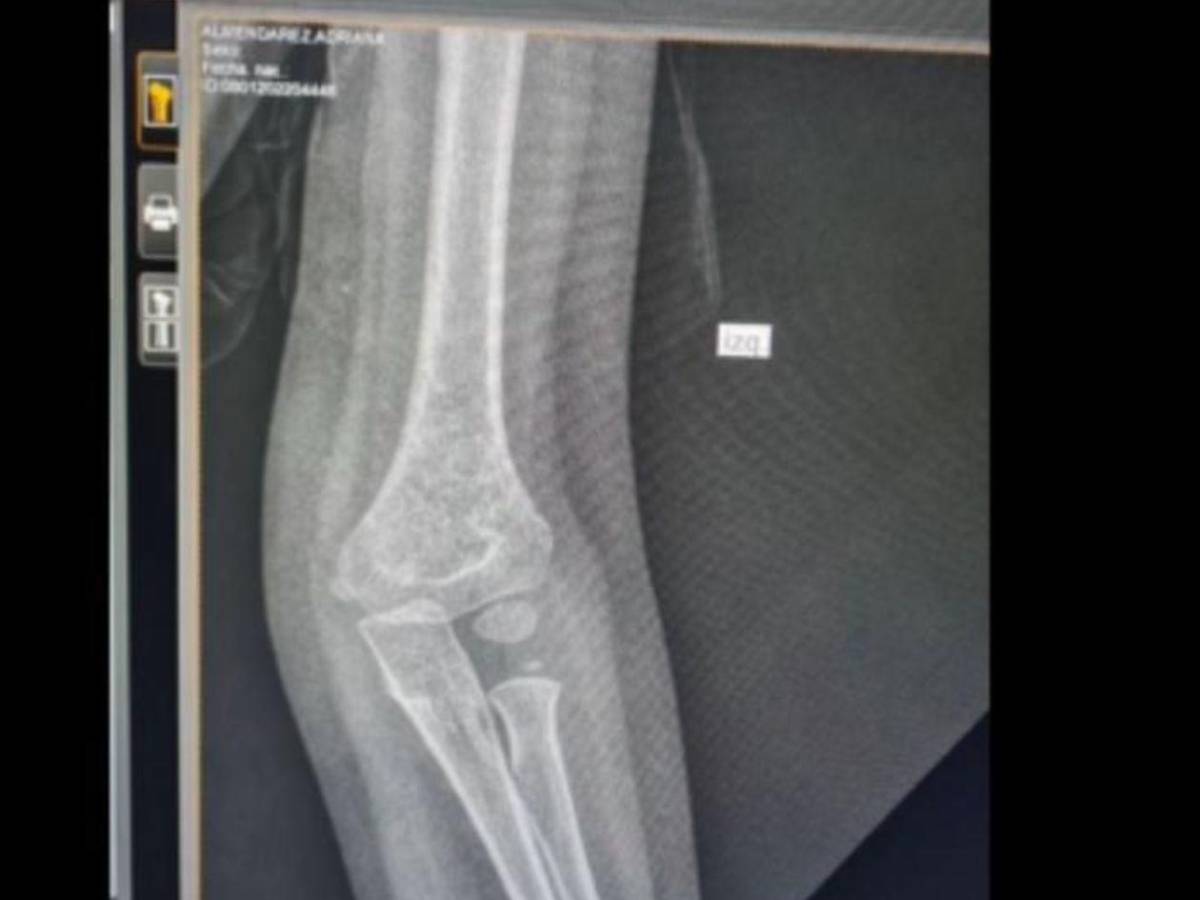 Francis Espinal revela preocupante realidad en el Seguro Social