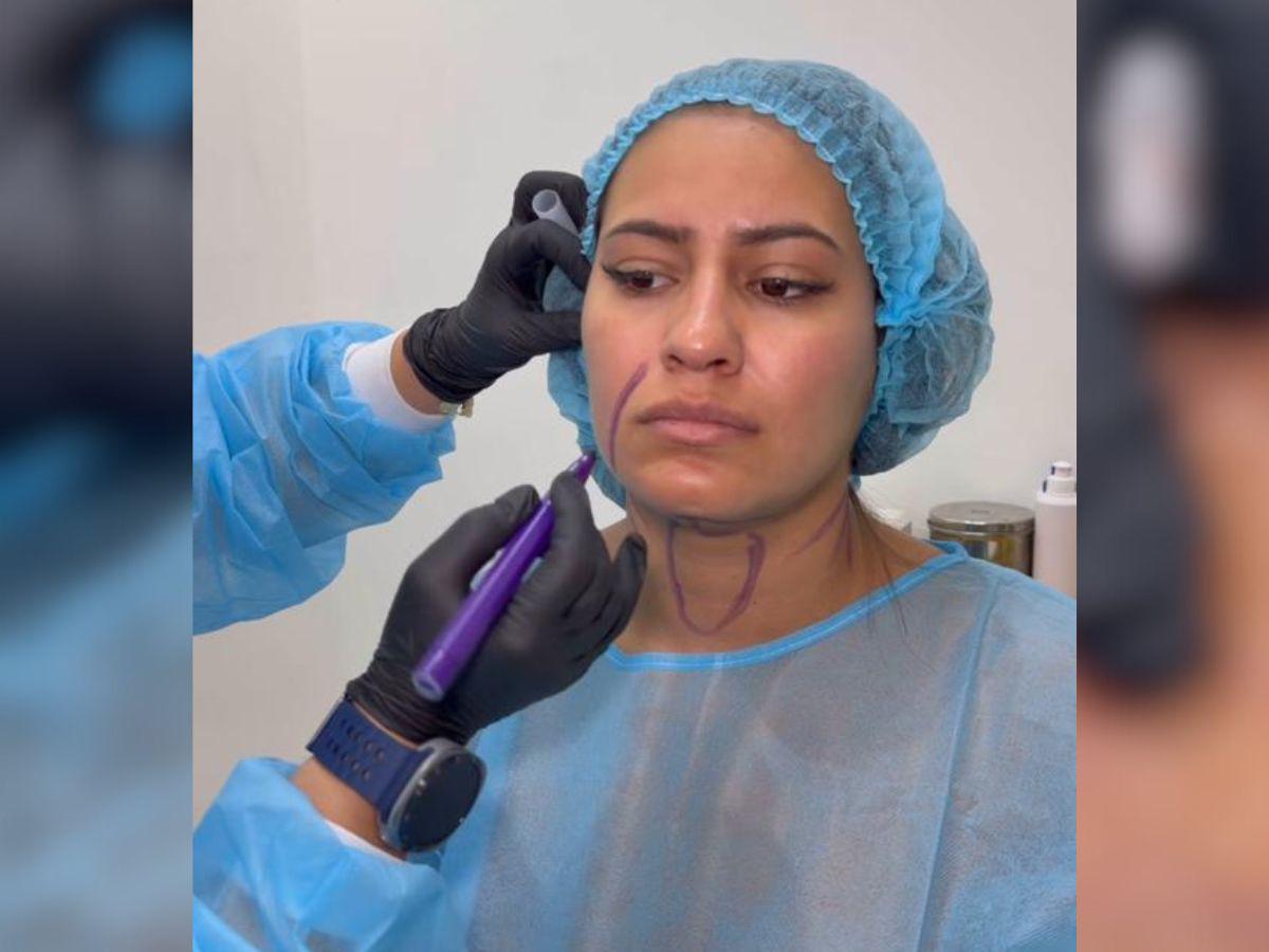 Alejandra Rubio se somete a nuevo procedimiento estético