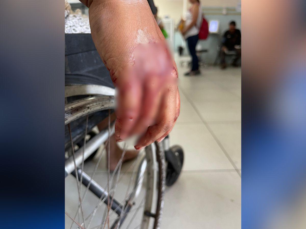 Con un bebé en brazos: Ingresan al Hospital Escuela heridos tras accidente de volqueta