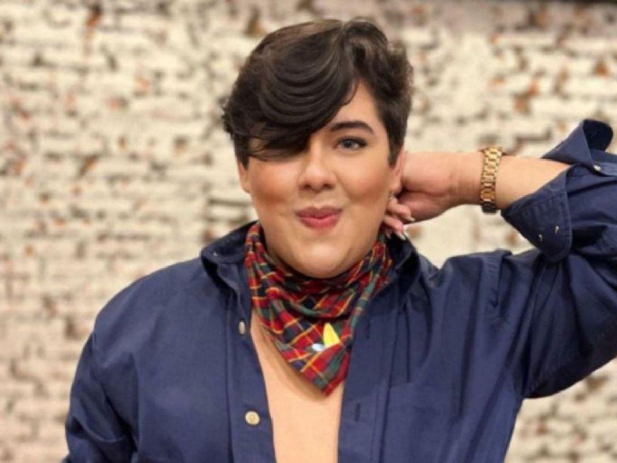 Antonio Sandrez presume sus nuevos labios: “Atáquense y admiren