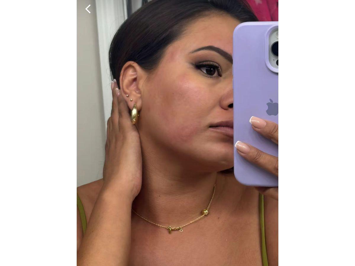 Alejandra Rubio reaparece con su rostro inflamado: ¿qué le pasó?
