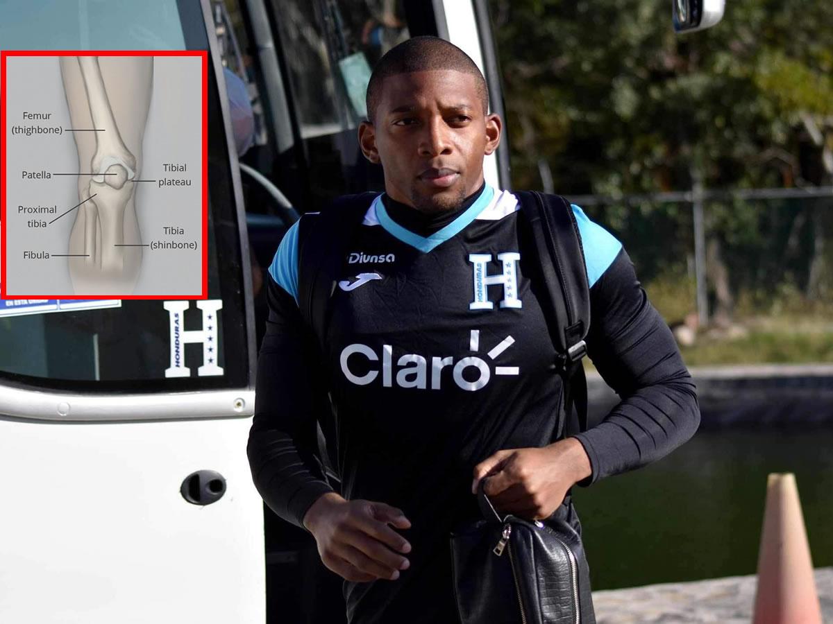 ‘Buba’ López, con pocas posibilidades de jugar ante Costa Rica; Rueda estudia opciones