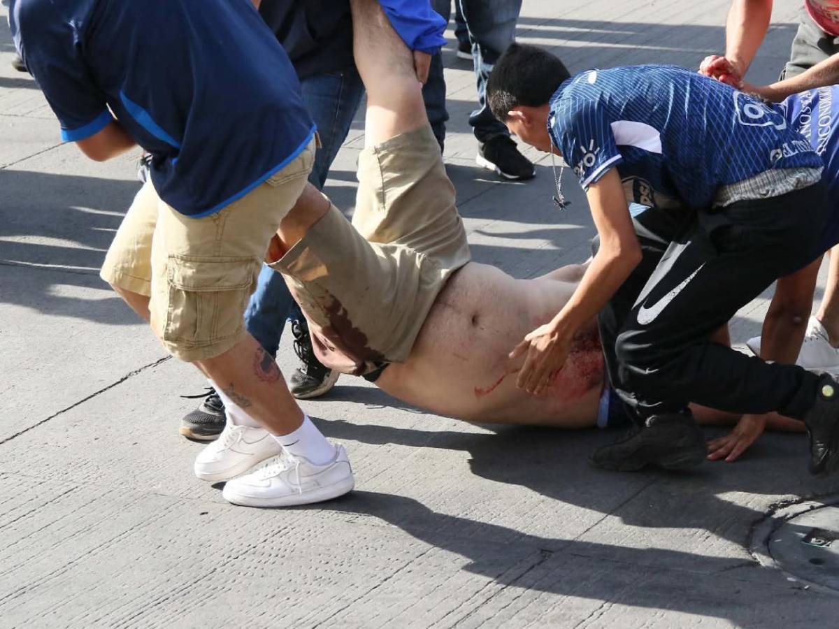 Imágenes impactantes: Terror en clásico Motagua - Olimpia tras escenas de violencia