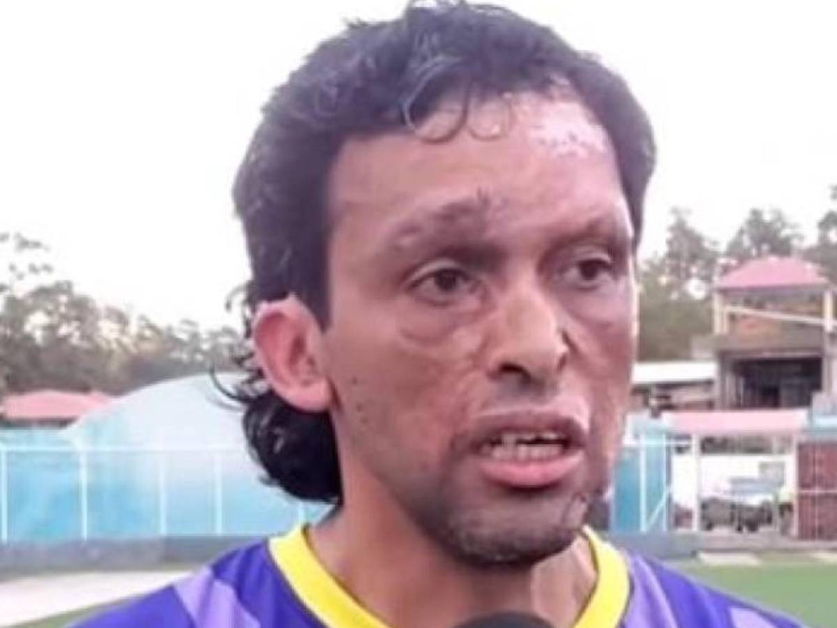 Tiktokers de Honduras vs El Salvador: Funcionario pide jugar la revancha