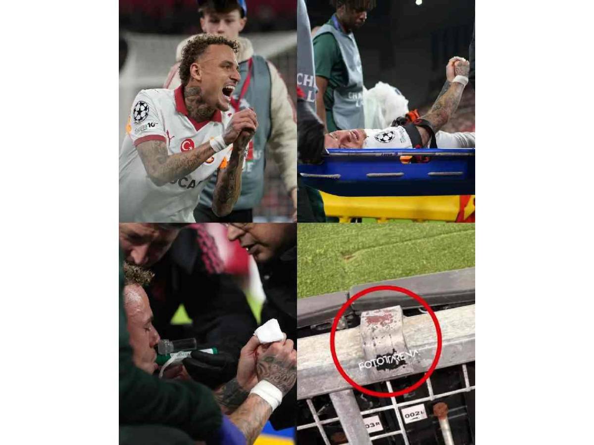 Impactante relato tras insólita lesión en Champions: “Mi pulgar quedó colgando”