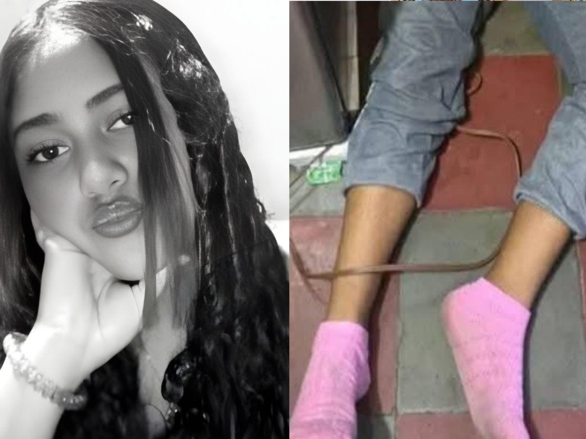 Le cortaron la lengua: asesinan a joven de 15 años en cuartería Comayagua