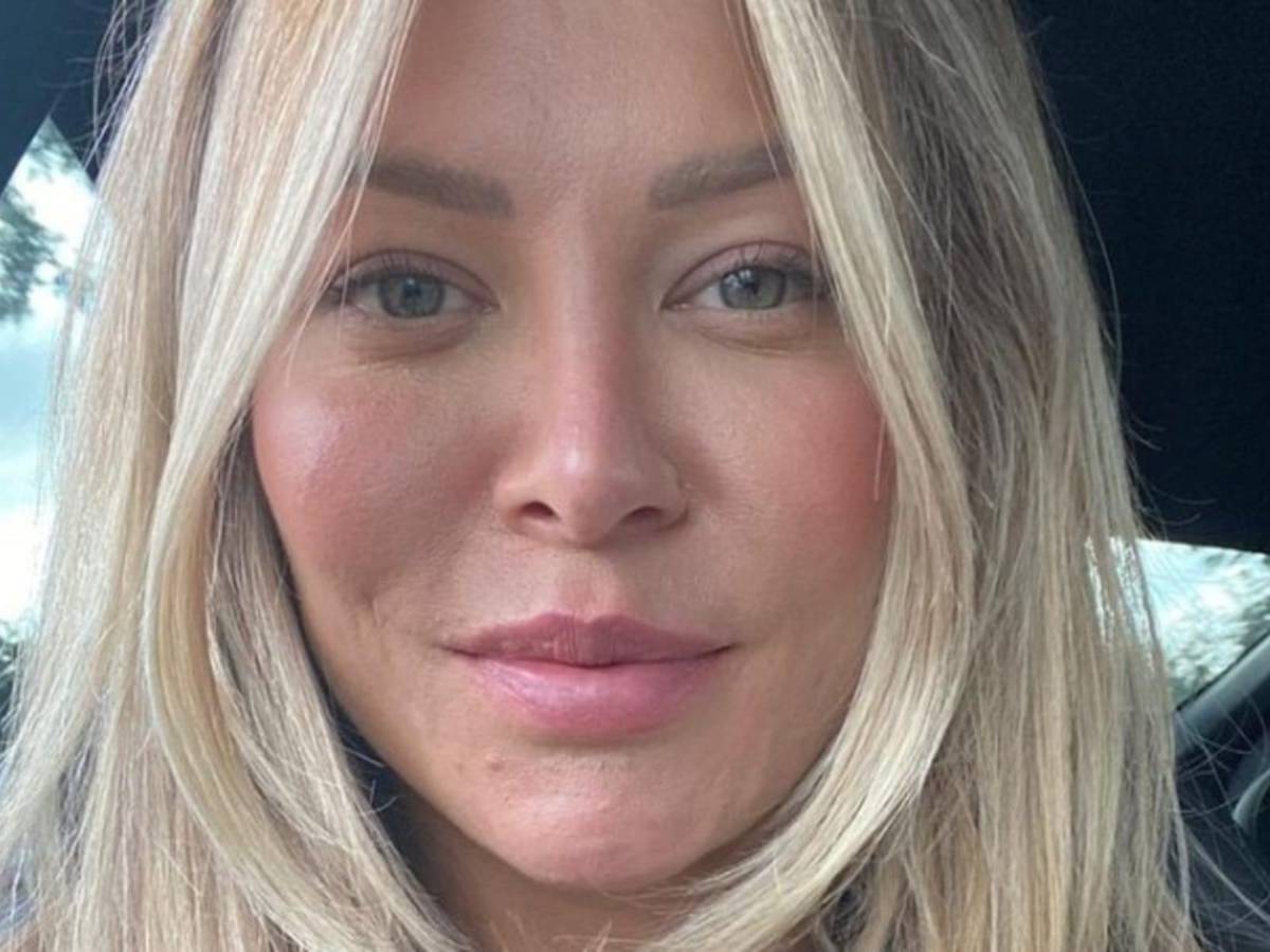 Fingió tener cáncer y estafó a su novio para pagar cirugías estéticas