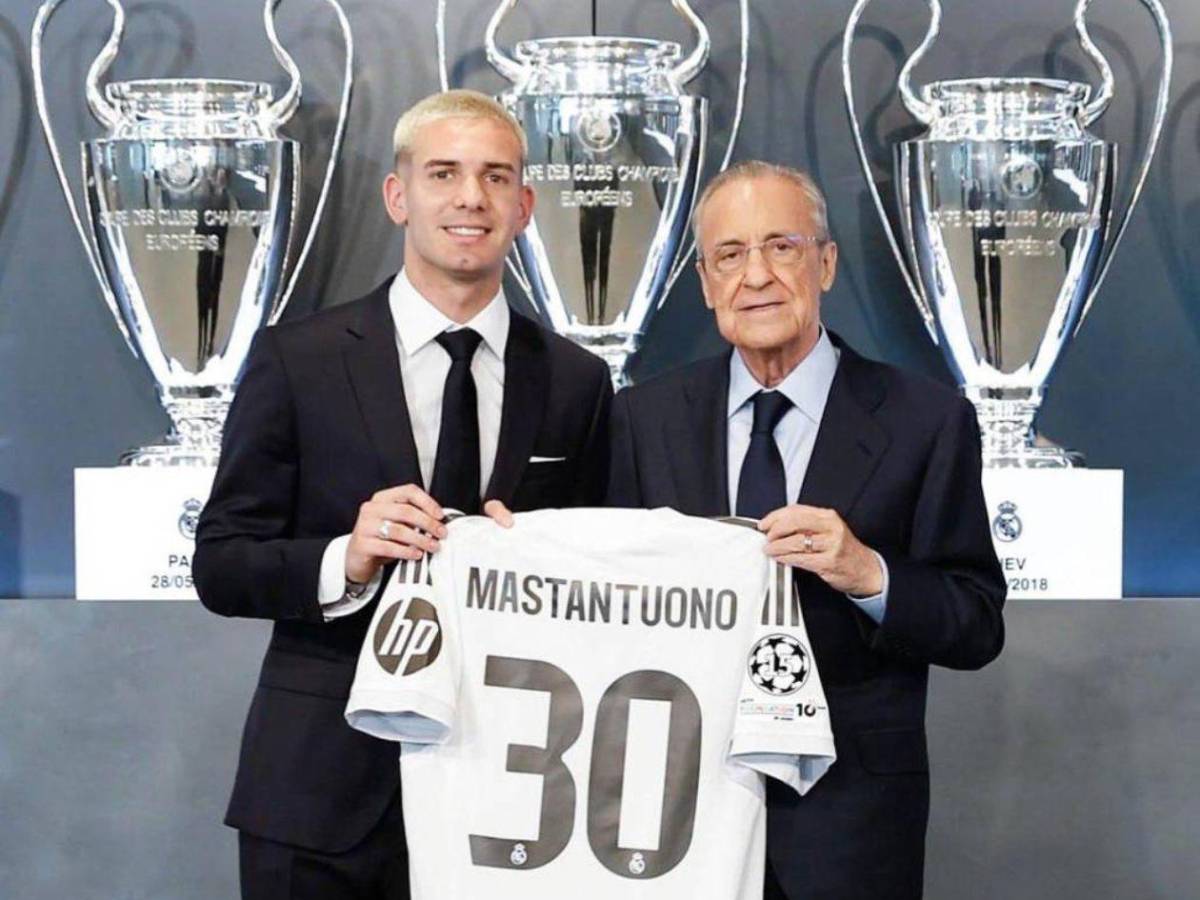 Real Madrid: la alineación de Xabi Alonso para el primer partido de la temporada