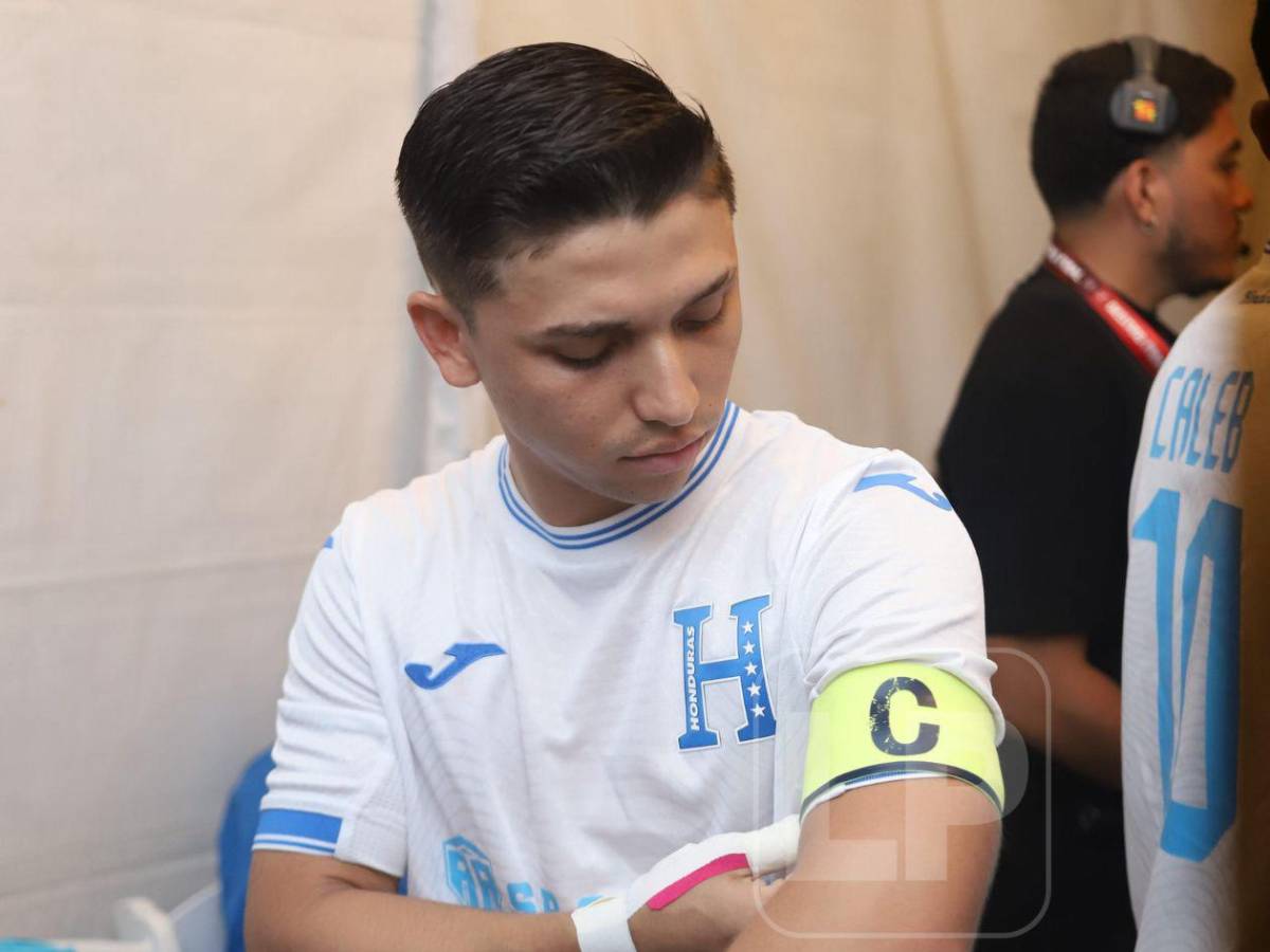 Polache brilla en el show, luego buscan culpable en el camerino