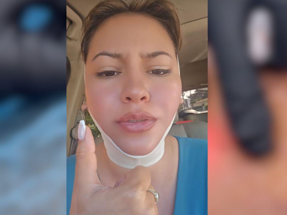 Alejandra Rubio se somete a nuevo procedimiento estético