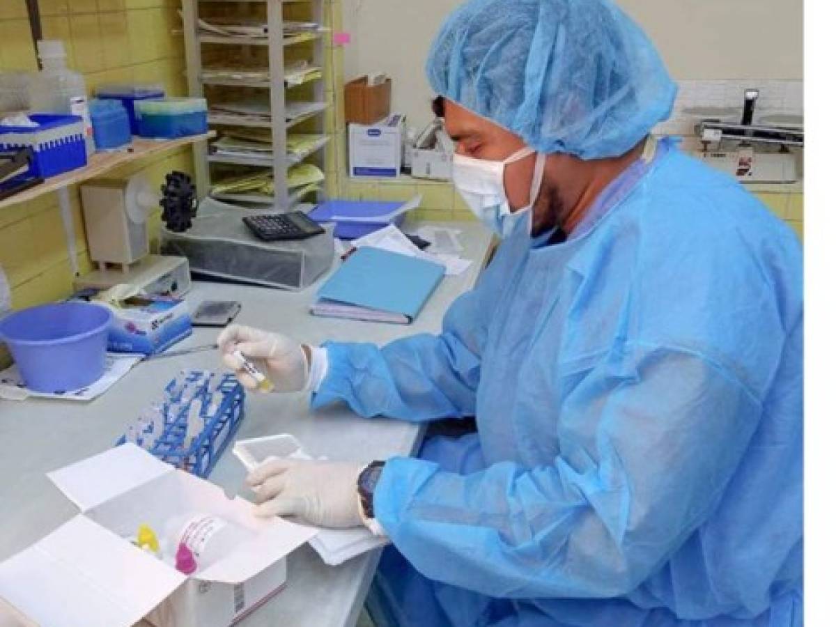 Mora de pruebas PCR está entre las 3,500 y 4,000, afirman microbiólogos