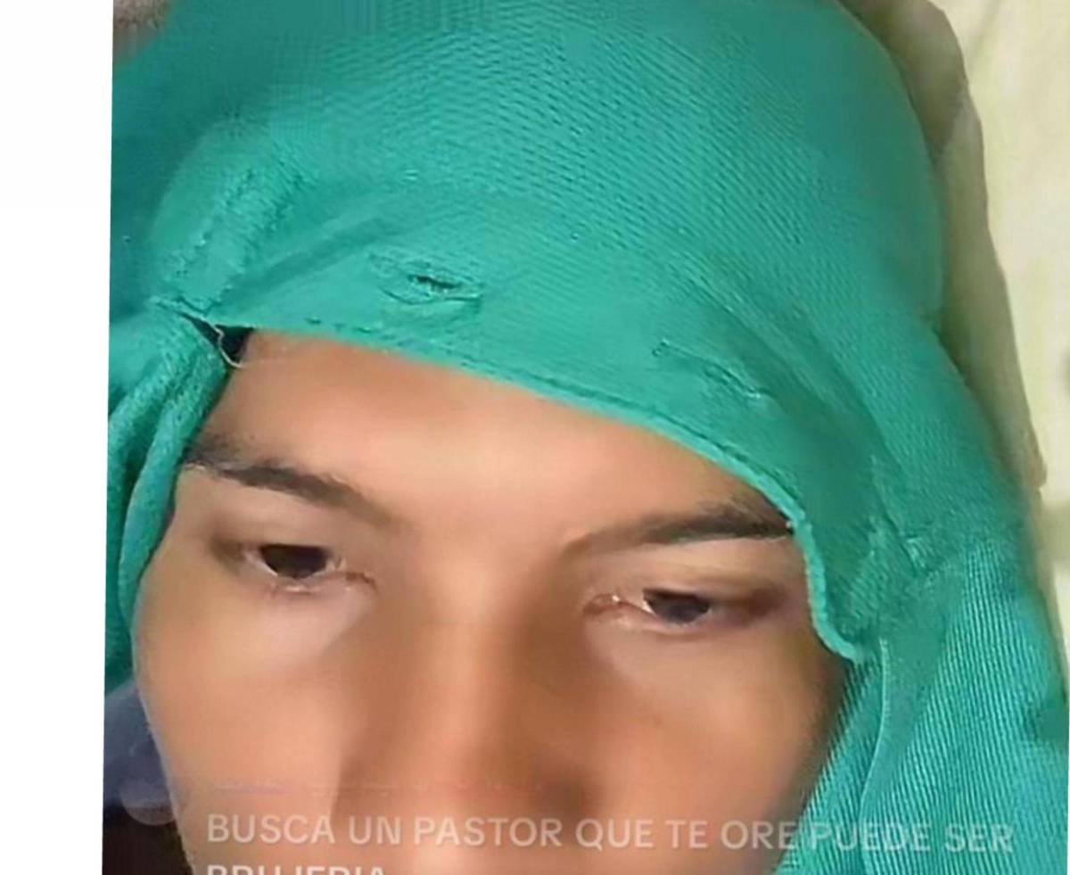 ¿Qué le pasó al Cristiano Ronaldo hondureño?: Dios me ayudará