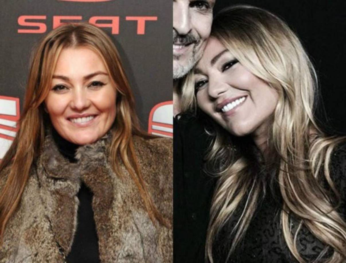 Además de la polémica de su rostro, la cantante fue acusada de dar un concierto en estado de ebriedad.