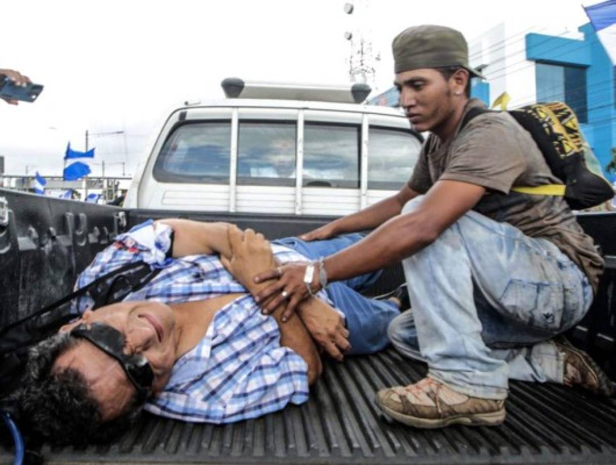 Uno de los heridos fue alcanzado en el brazo por disparos de hombres armados que iban a bordo de tres camionetas, y que, según testigos, atacaron a los manifestantes que protestaban contra Daniel Ortega.