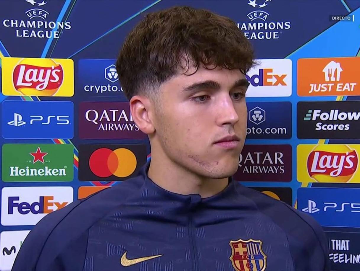 ¡Qué cicatriz! Así quedó el rostro de Pau Caubarsí tras el golpe que sufrió en el partido pasado de Champions.