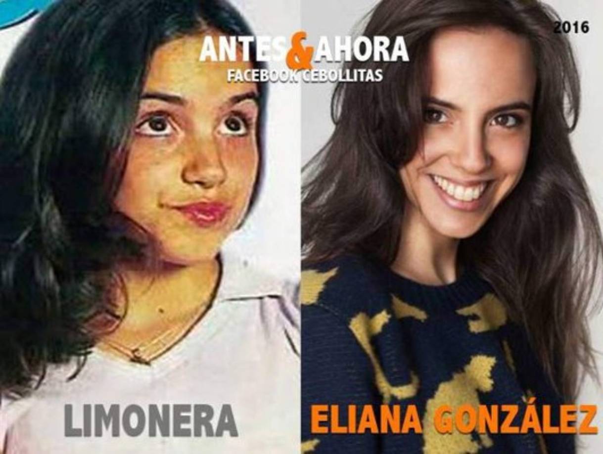 La Limonera (Eliana González) es actriz reconocida en la Argentina, ha aparecido en varias, series, novelas y películas.