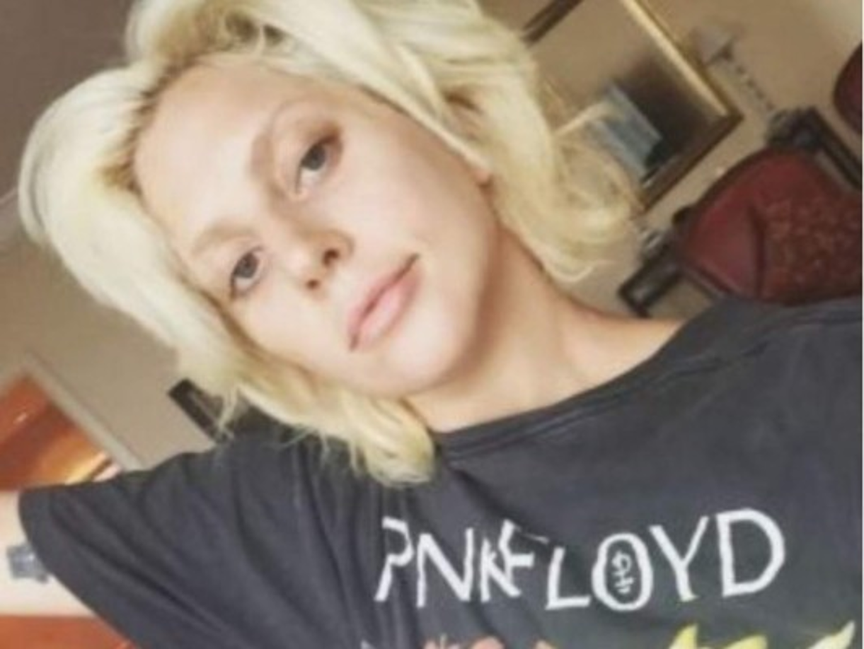 Lady Gaga, la reconocida cantante causó polémica al lucir al natural. En ese tiempo se especuló que tenía problema con las adicciones.