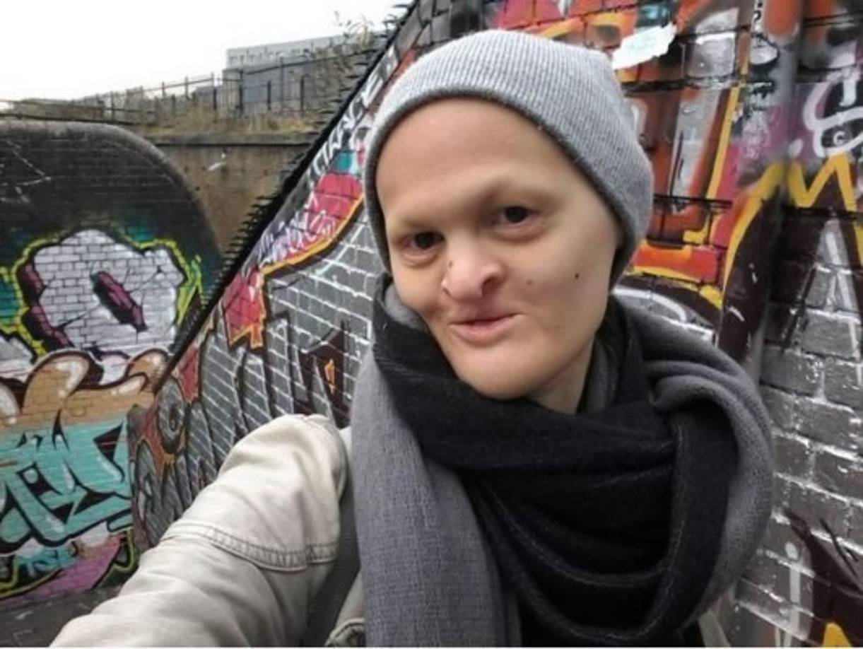 Actualmente soltera, la exestudiante de arte dice que ella pensó que terminaría viviendo como una reclusa, aislada de todos, y nunca imaginó se ganaría la vida como una modelo.<br/>